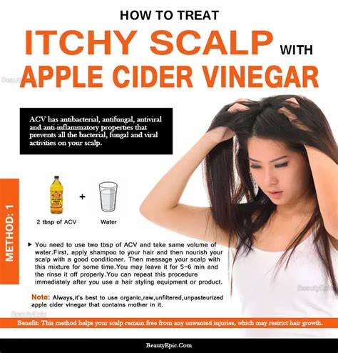 Can I use apple cider vinegar for dandruff?