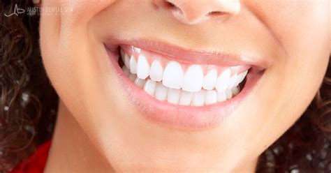 Can Teeth Whitening Damage Gums? - Austin Dental Spa