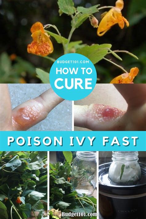 Can You Cure Poison Ivy Overnight? - Get Rid of Poison …