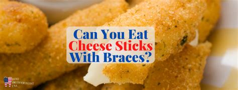 Can You Eat Cheese Sticks With Braces? (Only Soft Cheese)