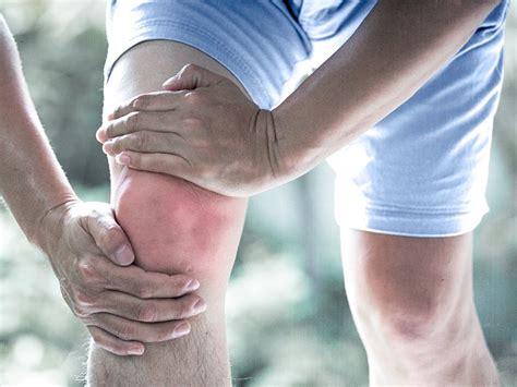 Can You Get Gout In An Artificial Knee - HealthyKneesClub.com