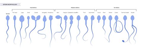 Can You Mix Two Different Sperms In Ivf