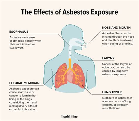 Can a Single Exposure to Asbestos Cause Cancer?