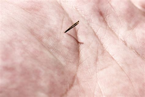 Can a splinter enter your bloodstream