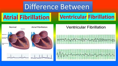 Can anyone tell me what the difference is b... - AF Association