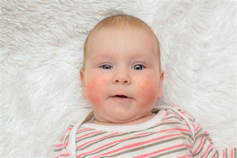Can babies be allergic to oranges.  Find out which ones to be aware of.  ...