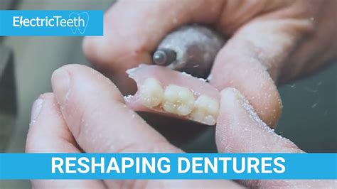 Can dentures be reshaped? - YouTube