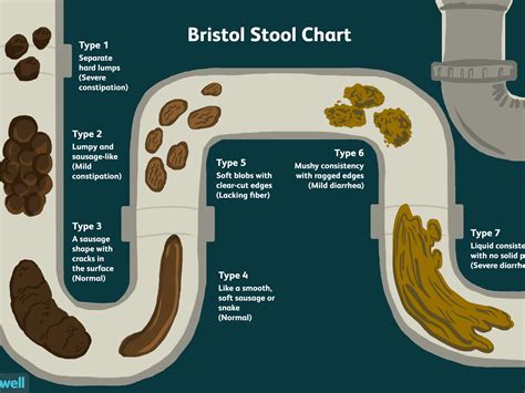 Summary. Stringy poop is when stool appears thin or narrow, often resembling strips of ribbon. Possible causes include dietary factors, irritable bowel syndrome (IBS), and infections. Less .... 