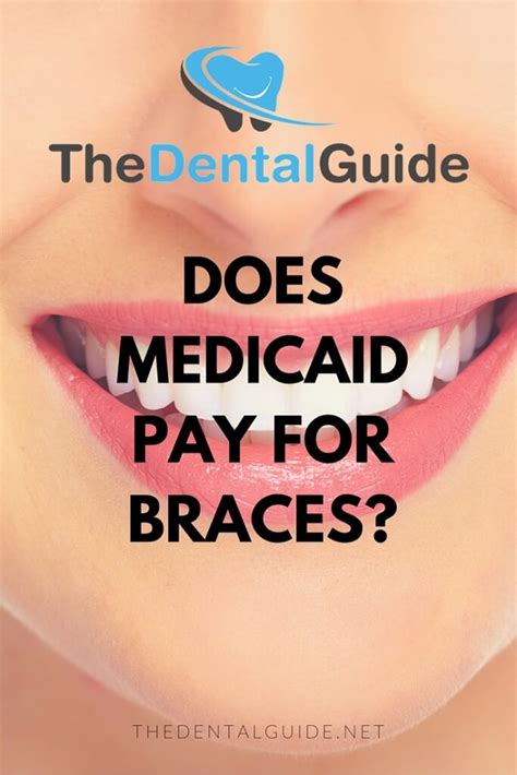 Can medicaid pay for braces. Things To Know About Can medicaid pay for braces. 
