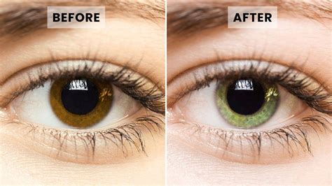 Can medication change your eye color? - singlecare.com