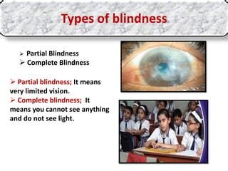 Can partial blindness be corrected