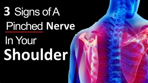 Can shoulder pain cause pins and needles? – WisdomAnswer