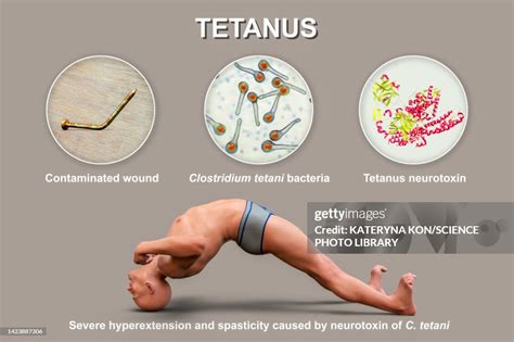 Can tetanus be spread from animals to humans? – Healthy Bite …