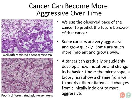 Cancer Science Evolves One Consent Form at a Time