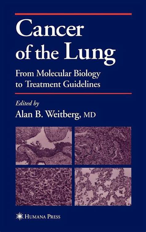 Cancer of the lung from molecular biology to treatment guidelines reprint. - Suzuki uc 150 manuale di riparazione.