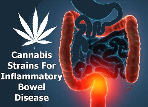 Cannabis For Inflammatory Bowel Disease