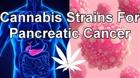 Cannabis and pancreatic cancer. Things To Know About Cannabis and pancreatic cancer. 