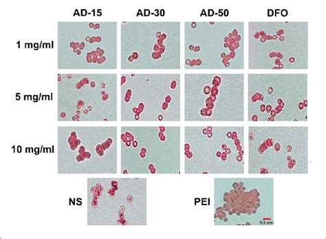 Capacity for red blood cell aggregation is higher in athletic ... - PubMed