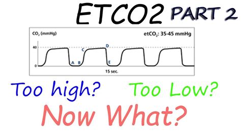 Capnography Waveform Interpretation Advanced Why perfusion matters