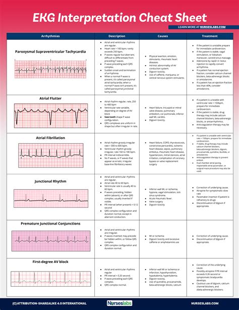 Cardiac Arrhythmia Recognition an easy learning guide