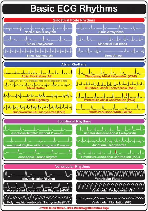 Cardiac Rhythm Cheat Sheet