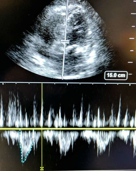 Cardiac output measurements via echocardiography versus …