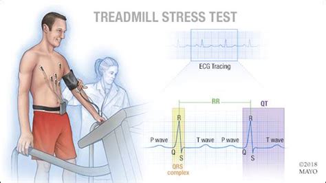 Cardiac stress test cpt code. A patient presents for a cardiac stress test at the hospital. The same physician supervises the test, interprets the study and documents the official report. What CPT® code(s) is/are reported? A) 93015 B) 93015-26 C) 93016, 93017, 93018 D) 93016, 93018 