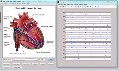 CardioModel New Software for Cardiac Electrophysiology Simulation