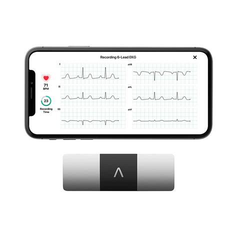 Cardiomobile. Things To Know About Cardiomobile. 