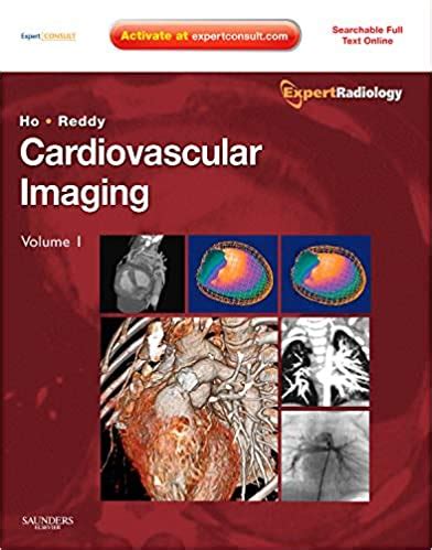Cardiovascular imaging 2 volume set expert radiology series 1e. - Sinaloa a través de sus constituciones.