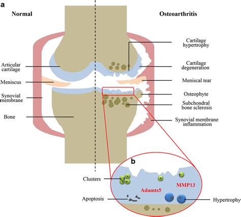 Cartilage, Joints, and Aging: What You Need to Know About OA - Healt…