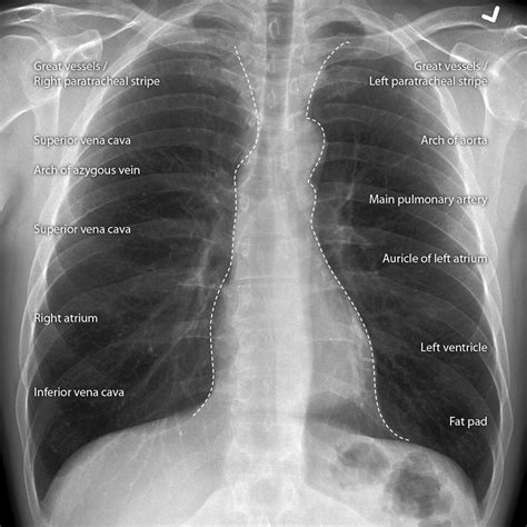 Cases System: Forensic Radiopaedia.org