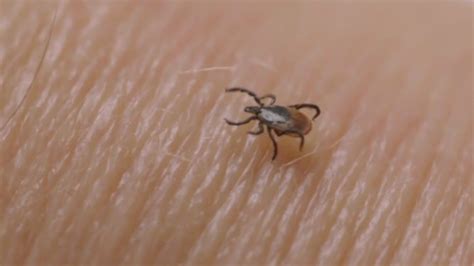 Cases of tick-borne illnesses are on the rise. Some experts believe climate change is the cause