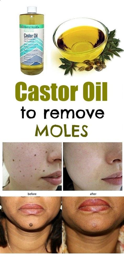 Castor oil and cayenne pepper for skin moles. 7) Essential Oils. Essential oils such as clove, lemongrass, rosemary, lavender, and thyme can get rid of groundhogs. Mix 5 to 10 drops of these essential oils in a spray bottle with water (or apple cider vinegar, which they also find repulsive), and apply it around your garden. 