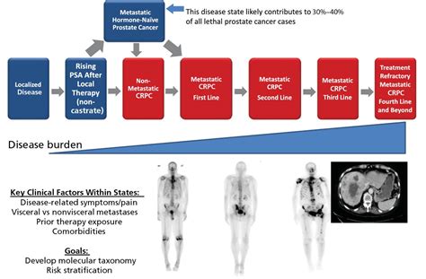 Castrate-Resistant Prostate Cancer – New Treatments?