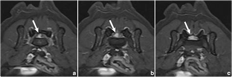 🍑 XXX Cat_Lauryn  Onlyfans Leak