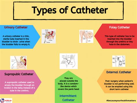 Catheter types.  Indwelling catheterization In this type of catheterization, one end of ...