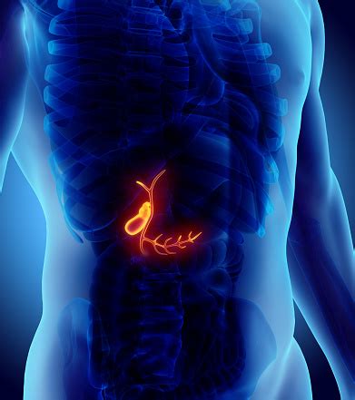 Causes Of Contracted Gallbladder: Symptoms & Natural Treatment