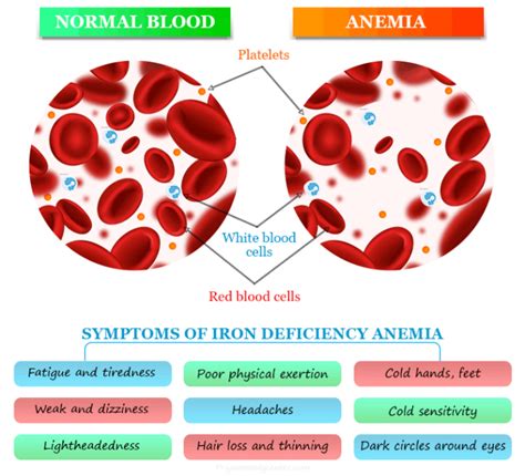 Causes Of High Iron Levels In Blood: Symptoms And Treatment