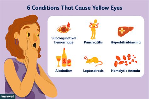 Causes and Conditions of Yellow Eyes