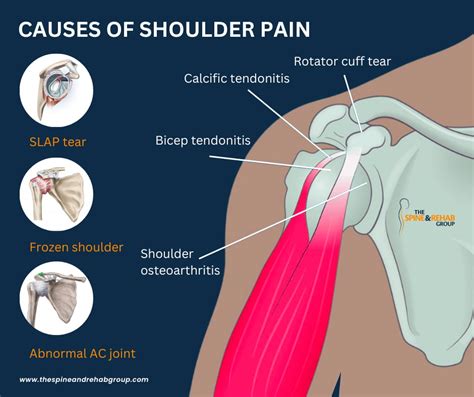 Causes of Pain on the Right Side of the Neck Down to the Shoulder