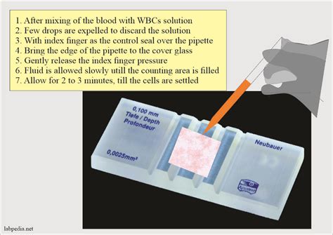 Cbc-procedure - Hematology - WBC COUNT TLC or WBC pipette