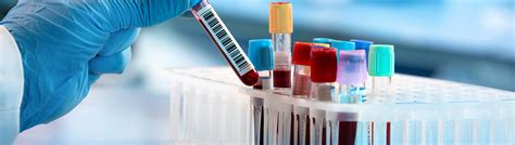 Ce certification.  LabCE provides CE to over 400,000 medical laboratory scientists, medic...