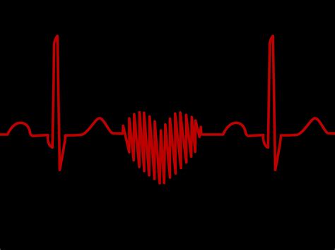Cedars Sinai Team Develops Risk Assessment Score to Predict and Help Prevent Sudden Cardiac Arrest