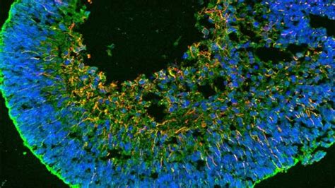 Cell fusion ‘awakens’ regenerative potential of human retina