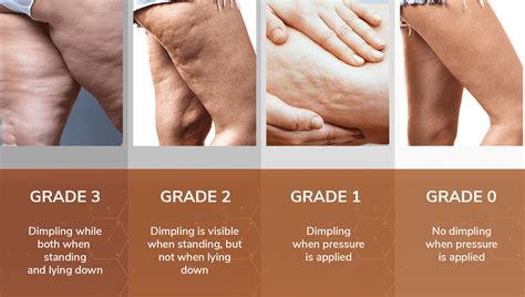 💋 Cellite Leaks XXX 59 Videos