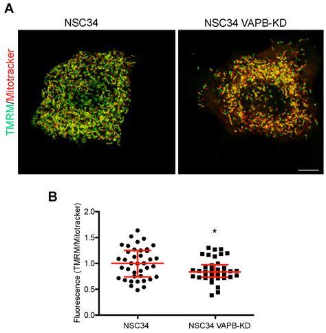 Cells Free Full-Text The Link between VAPB Loss of Function and ...