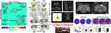 Center for Translational NeuroImaging (CTNI) - Division …