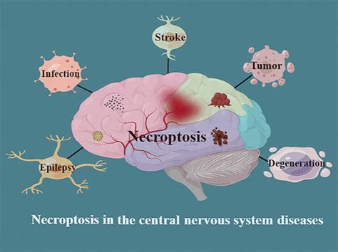 Central Nervous System Disorders Patterns of Localization GrepMed