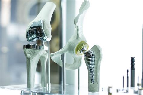 Ceramic Bearings for Bones: The Future of Orthopedic Surgery